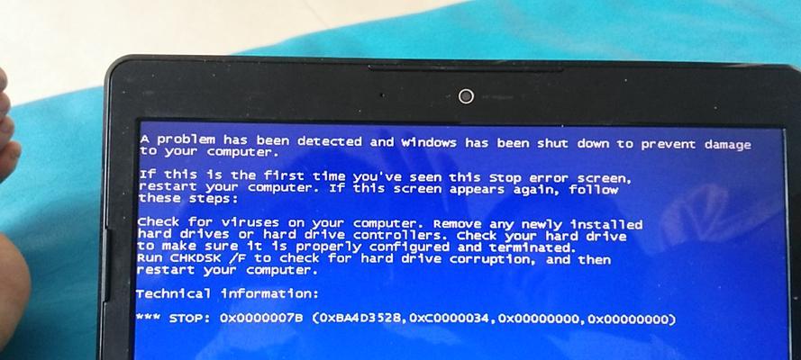 解决笔记本电脑蓝屏问题的有效方法（学会应对笔记本电脑蓝屏）