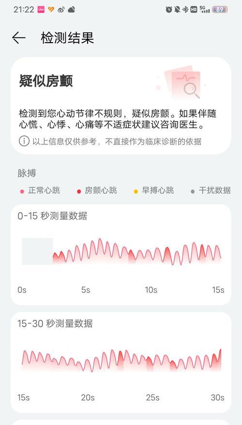 如何使用华为手环6测量心率(华为手环6心率检测方法与注意事项) 如何使用华为手环6测量心率(华为手环6心率检测方法与注意事项)