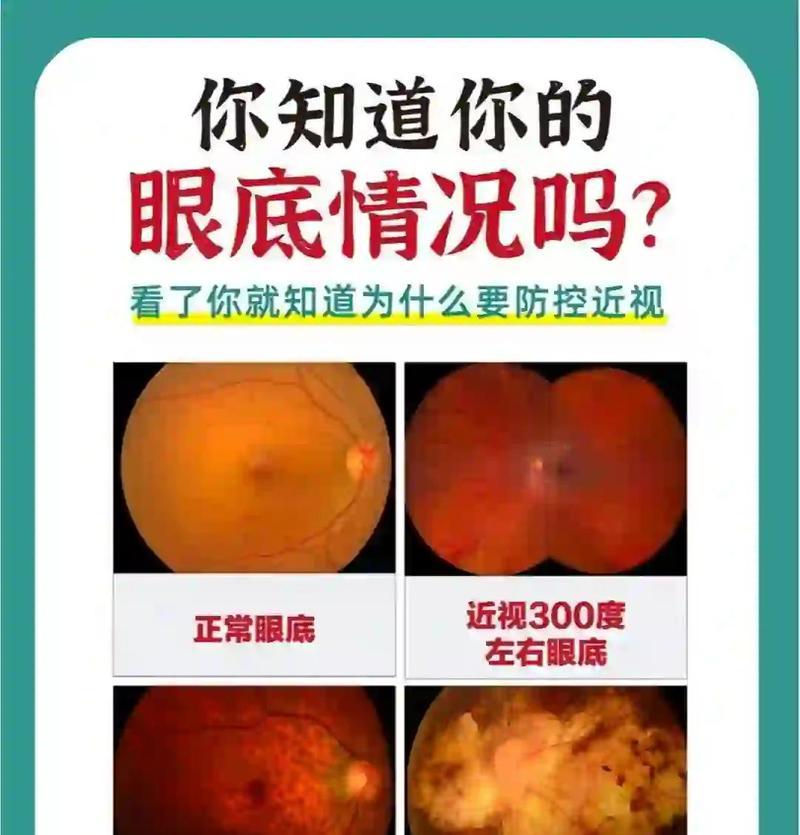 视网膜屏幕的优点与应用（探索视网膜屏幕的技术原理）
